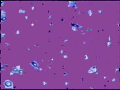 sperm.jpg